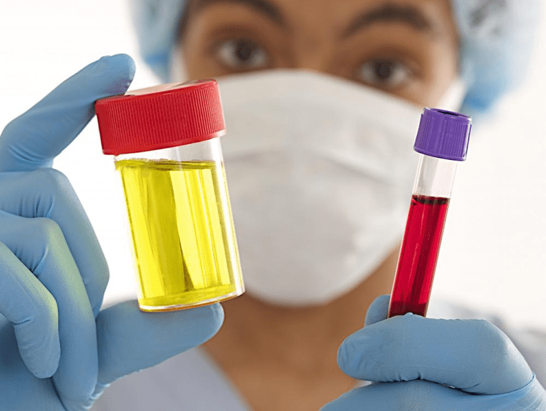 Drug Test Samples