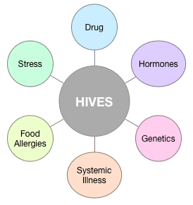 Hives-Causes