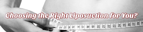 Right Liposuction for You