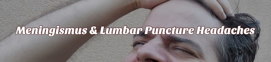 Lumbar Puncture Meningismus Headaches