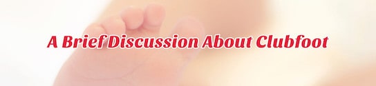 Discussion About Clubfoot