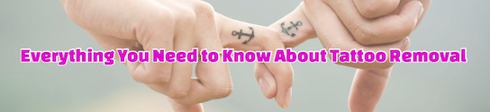 About Tattoo Removal