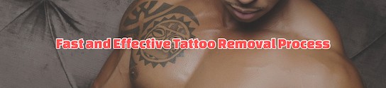 Effective Tattoo Removal Process