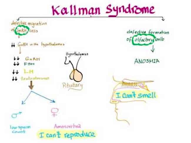 Kallmann Syndrome Blog Post