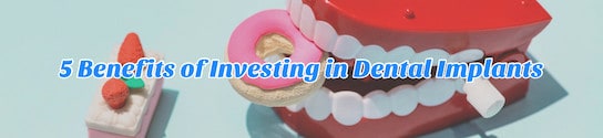 5 Benefits of Investing in Dental Implants