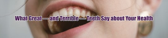 Healthy teeth Blog Header