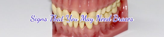 Signs That You May Need Braces Header