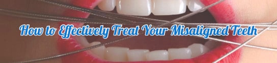 How to Effectively Treat Your Misaligned Teeth