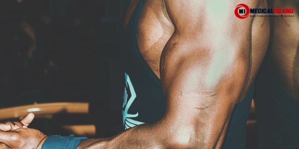 Biceps Tendonitis Blog Post