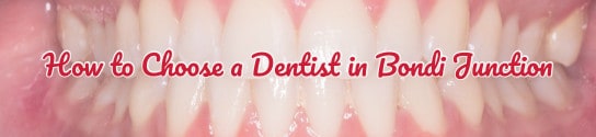 How to Choose a Dentist in Bondi Junction