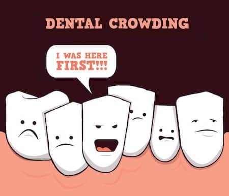 Funny Dental Alignment Cartoon
