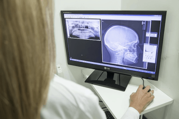Where Can I Go For An X ray Near Me 